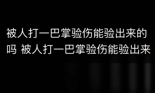 被人打一巴掌验伤能验出来的吗 被人打一巴掌验伤能验出来的吗视频